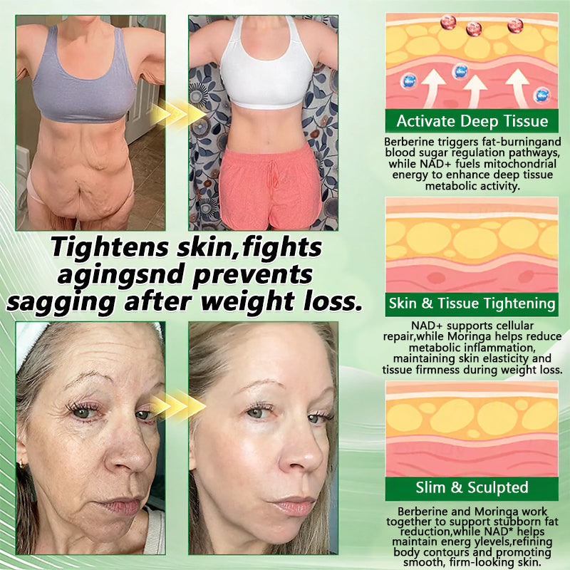 𝐑𝐞𝐜𝐨𝐦𝐦𝐞𝐧𝐝𝐞𝐝 𝐛𝐲 𝐭𝐡𝐞 𝐃𝐨𝐜𝐭𝐨𝐫 𝐢𝐧 𝐌𝐞𝐝𝐢𝐜𝐢𝐧𝐞 👩‍⚕️| 𝙈𝑼𝐑𝒲𝓞𝙽® 𝑴-𝑩-𝙉 𝟭𝟬-𝙞𝓷-𝟏 𝙉𝙖𝙣𝒐 𝑭𝓾𝙨𝙞𝙤𝙣 𝙈𝓮𝓽𝙖𝙗𝙤𝒍𝒊𝓬 𝑷𝒂𝒕𝓬𝙝 ✨ | 𝙎𝙘𝙞𝙚𝙣𝙘𝙚-𝗕𝗮𝗰𝗸𝗲𝗱 𝑴𝒆𝒕𝒂𝒃𝒐𝒍𝒊𝒄 𝑺𝒖𝒑𝒑𝒐𝒓𝒕 | 𝟭𝟎-𝒊𝒏-𝟏 𝙁𝙤𝙧𝒎𝒖𝒍𝒂 | 𝙑𝙞𝙨𝙞𝙗𝙡𝙚 𝑹𝒆𝒔𝒖𝒍𝒕𝒔 𝙞𝙣 7 𝘿𝙖𝙮𝙨 🥦