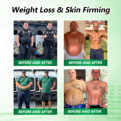𝑶𝒇𝒇𝒊𝒄𝒊𝒂𝒍 𝒔𝒕𝒐𝒓𝒆  | 🎗️𝐌𝐮𝐫𝒘𝒐𝒏® 𝐌𝐨𝐫𝐢𝐧𝒈𝗮 𝑩𝒆𝒓𝒃𝒆𝐫𝐢𝐧𝐞 𝐱 𝐍𝗔𝒟+ 10-𝑖n-1 𝐍a𝒏𝒐 𝐌𝐢𝐜𝐫𝑜𝑛𝑒𝑒𝗱𝗹𝗲 𝐏𝐚𝒕𝒄𝒉🇺🇸(𝐉𝐮𝐬𝐭 𝐨𝐧𝐜𝐞 𝐚 𝐝𝐚𝐲, 𝐯𝐢𝐬𝐢𝐛𝐥𝐞 𝐜𝐡𝐚𝐧𝐠𝐞𝐬 𝐢𝐧 𝟕 𝑫𝐚𝐲𝐬） ✅ 𝐅𝐨𝐫 𝐎𝐛𝐞𝐬𝐢𝐭𝐲,  𝙇𝙊𝙊𝙎𝗘 𝗦𝗞𝗜𝗡,𝐝𝐢𝐚𝐛𝐞𝐭𝙚𝙨, 𝐬𝐥𝐞𝐞𝐏 𝐚𝐩𝐧𝐞𝐚, 𝐣𝐨𝐢𝐧𝐭 𝐢𝐬𝐬𝐮𝙚𝙨, 𝐚𝐧𝐝 𝐦𝐨𝐫𝐞